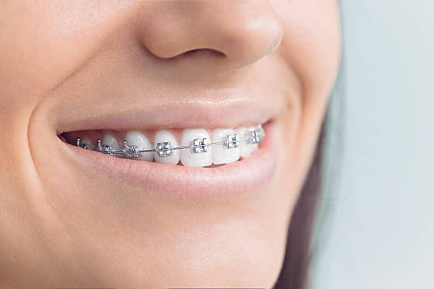 Best Tooth Extraction  in Summit, AZ